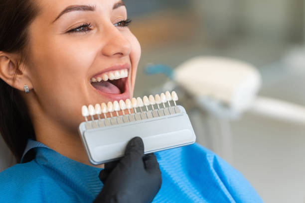 Istanbul teeth whitening