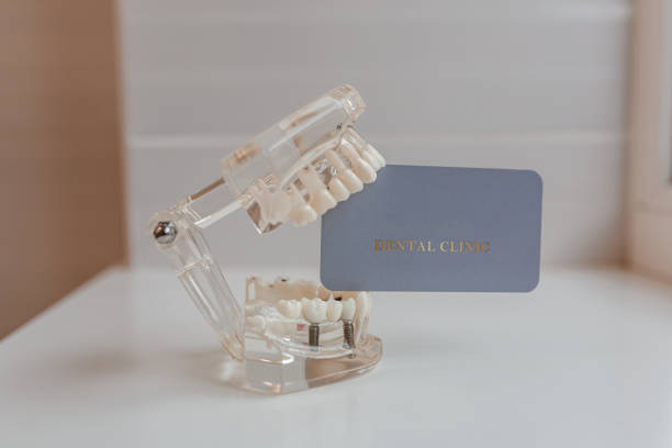 Full mouth dental implants Turkey package deals