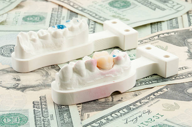 dental crowns Turkey cost
