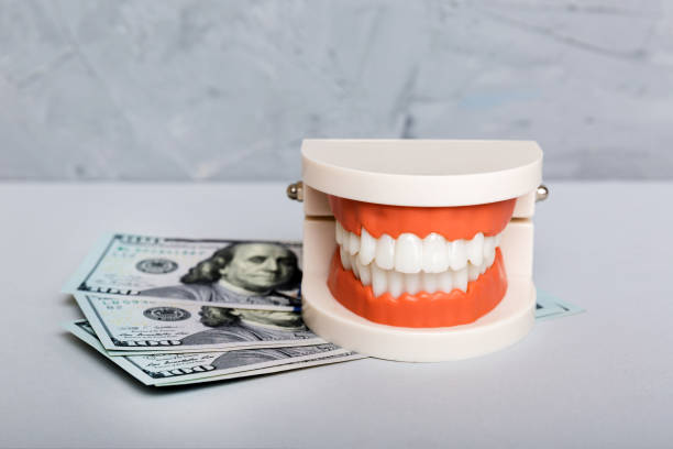 Turkey teeth cost All on 4