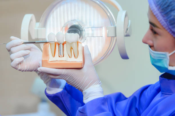 Is it worth getting dental implants in Turkey?