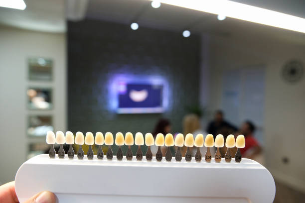 Full mouth dental implants Turkey price Antalya