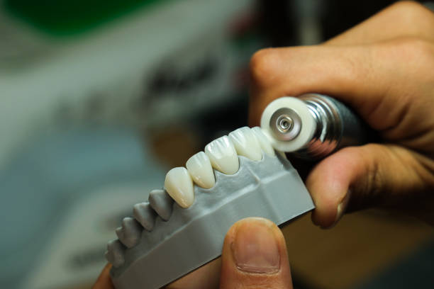 Antalya vs Istanbul for Dental Work – Which is Better in 2026?
