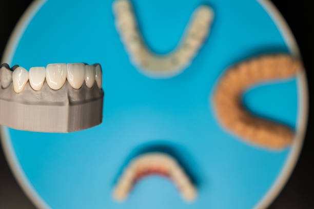 Turkey teeth prices Antalya