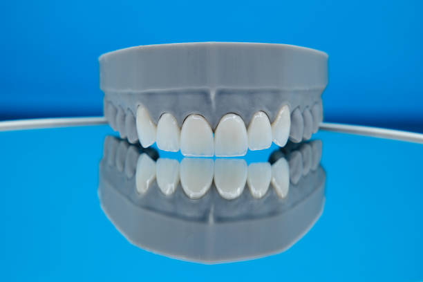 dental clinics Antalya vs Istanbul