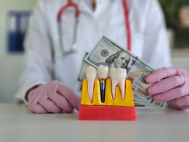 All-on-6 dental implants Turkey price