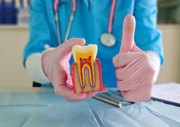Best veneers Turkey