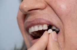 Dental Crowns Turkey – Prices, Types & Full Guide 2026
