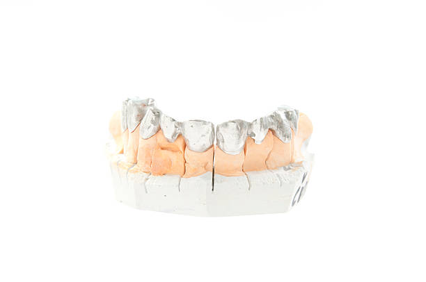 crowns Istanbul price